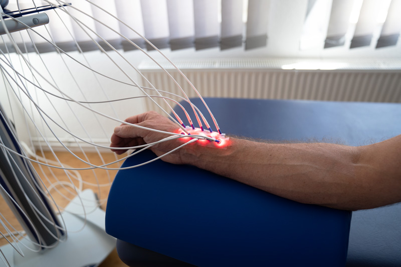 Laserneedle-Therapie für Patienten aus Stadthagen, Hannover, Bielefeld, Herford, Rinteln, Minden und Umgebung